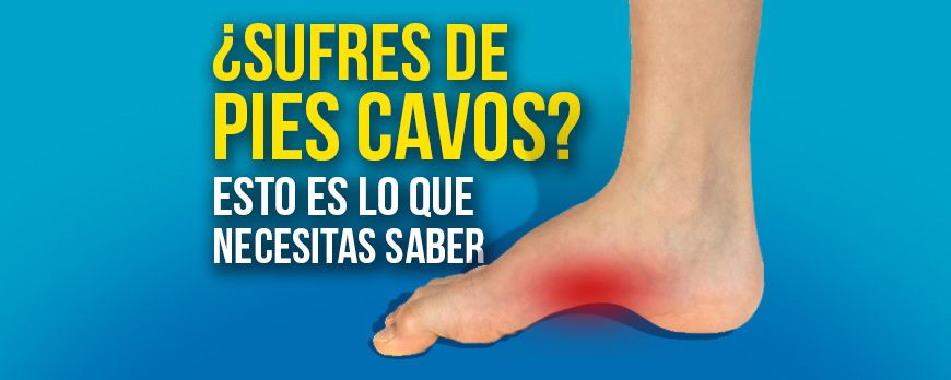 Do you suffer from cavus feet? This is what you need to know