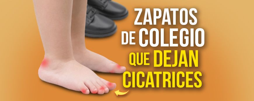 Zapatos de colegio que dejan cicatrices: mi experiencia y cómo proteger a tu hijo