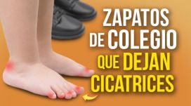 Zapatos de colegio que dejan cicatrices: mi experiencia y cómo proteger a tu hijo