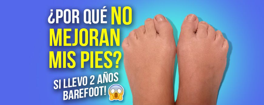 2 anos com sapatos descalços e ela não está melhorando