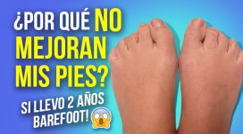 2 años con calzado barefoot y no mejora